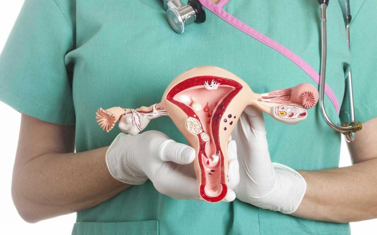 Apenas 1% de todas as mulheres reconhecem este sintoma de câncer de ovário ➤ Buzzday.info