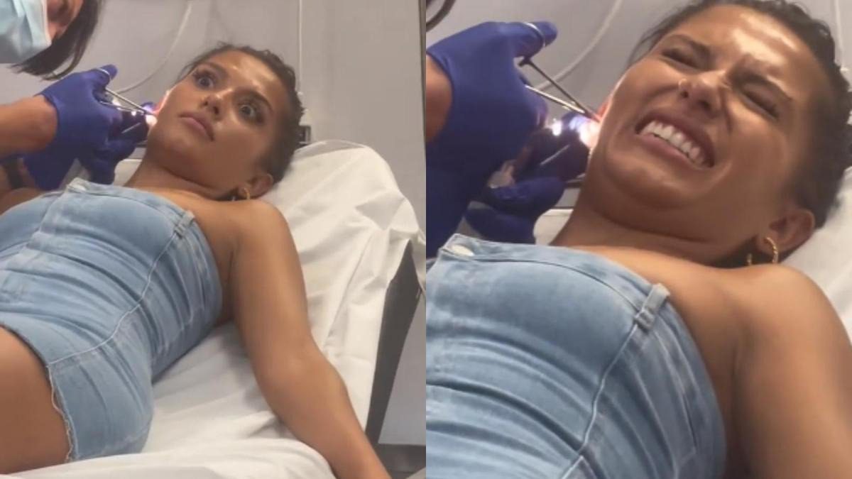 En vídeo: una mujer se quejó a un médico de molestias en el oído y le extrajeron un enorme insecto ➤ Buzzday.info