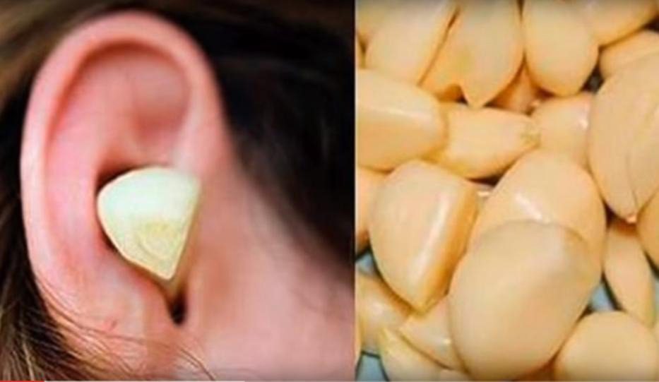 Mi a haszna annak, ha egy darab fokhagymát vagy hagymát dugunk a fülünkbe? ➤ Buzzday.info