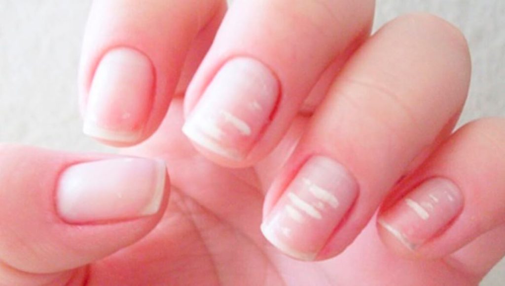 Veja como são as suas unhas e diremos como elas são saudáveis