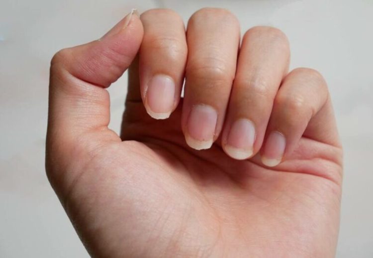 Veja como são as suas unhas e diremos como elas são saudáveis