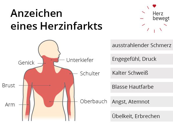 10 Zeichen, dass ein Herzinfarkt bevorsteht