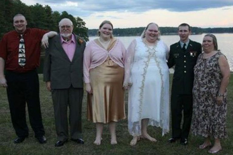 Todos riram quando ele se casou com ela, veja como ela está hoje