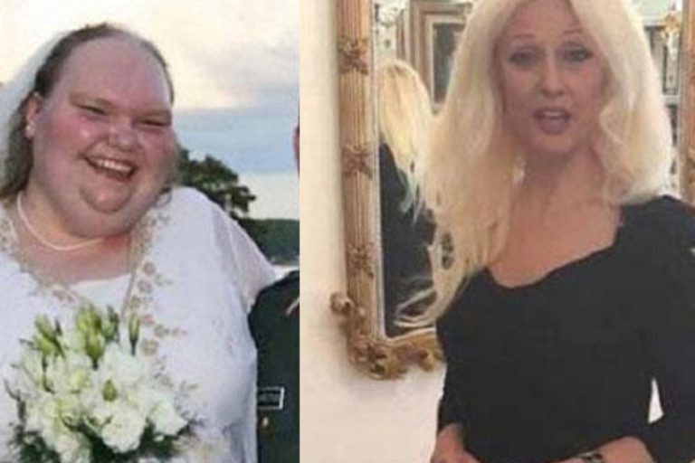 Todos riram quando ele se casou com ela, veja como ela está hoje