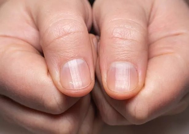 La velocidad de crecimiento de las uñas puede indicar cuánto tiempo vivirás ➤ Buzzday.info