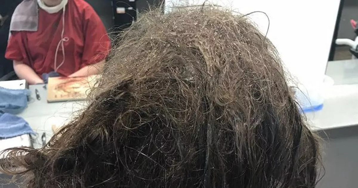 Egy fodrász levágta egy tinédzser haját, és ezt találta benne ➤ Buzzday.info
