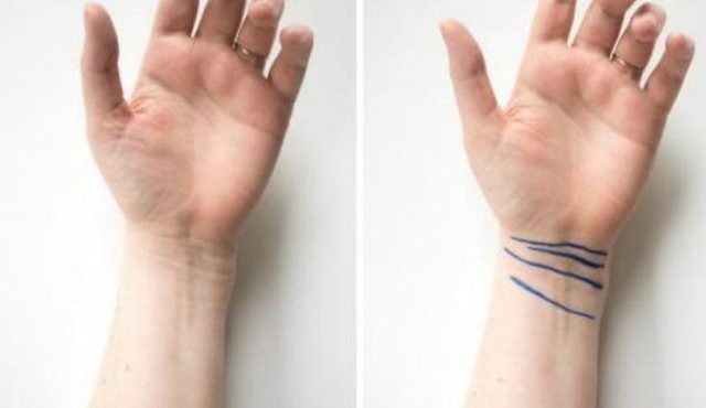 Haben Sie diese Streifen an Ihrem Handgelenk? Finden Sie heraus, was jeder von ihnen bedeutet