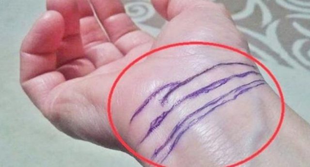 Haben Sie diese Streifen an Ihrem Handgelenk? Finden Sie heraus, was jeder von ihnen bedeutet