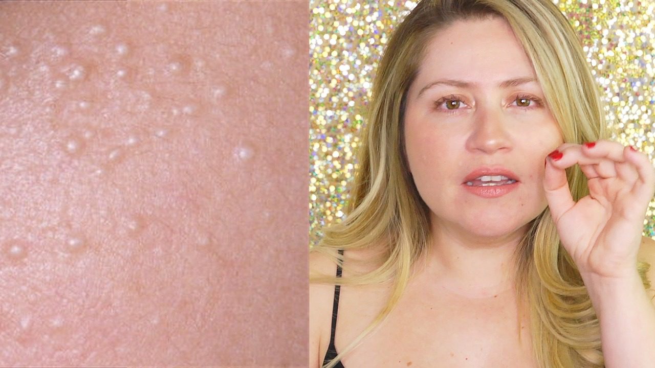 El significado de por qué a veces aparecen pequeñas manchas blancas en el cuerpo. A veces pueden tener problemas graves.