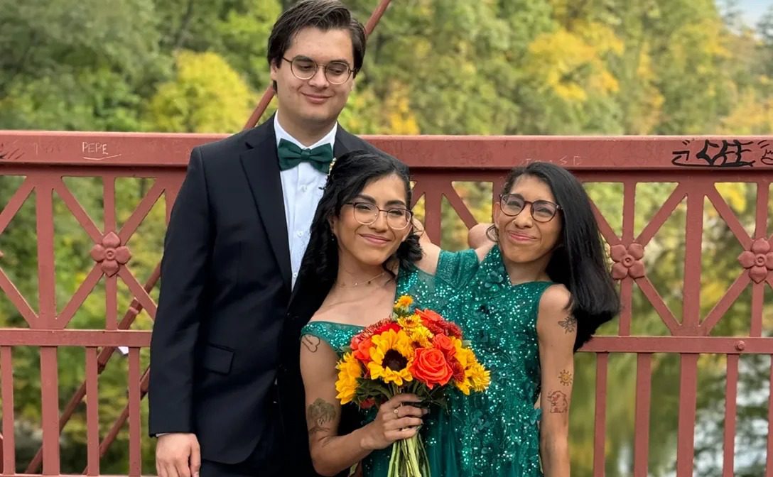 Las gemelas mexicanas de 25 años, unidas por la cadera, hablaron abiertamente sobre la vida privada de su hermana casada